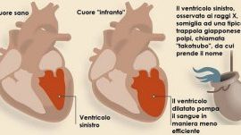 Journal of Cardiology Cases