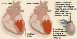 Journal of Cardiology Cases