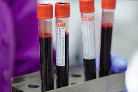 Sangue coltivato in laboratorio Sangue coltivato in laboratorio