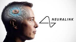 Start-up Neuralink