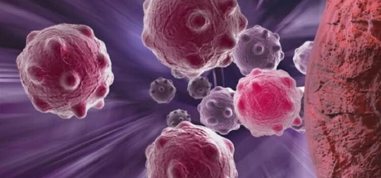 Esplosione dei “Tumori Turbo” tra i Giovani Vaccinati – Nuove Ricerche Esplosione dei “Tumori Turbo” tra i Giovani Vaccinati – Nuove Ricerche