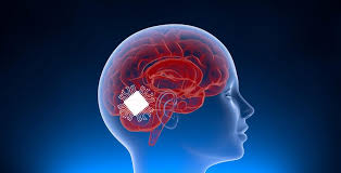 Neuralink: chip cerebrale Neuralink: chip cerebrale